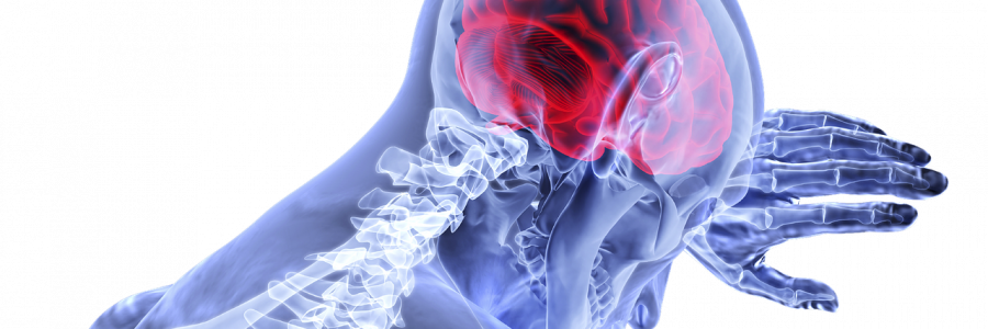 Get Off My Nerves: The Neuroscience of Pain