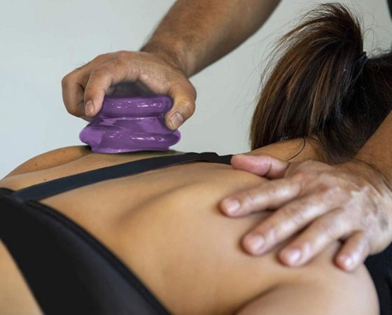Cupping Therapy 101