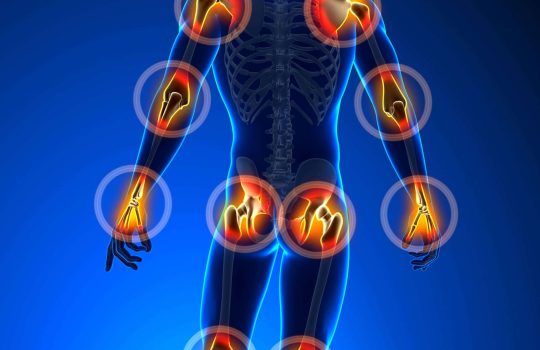 I Am Experiencing Pain – What Are My Options?